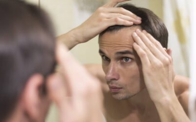 Mitos y verdades del microimplante capilar: ¿qué tenés que saber antes de tomar una decisión?